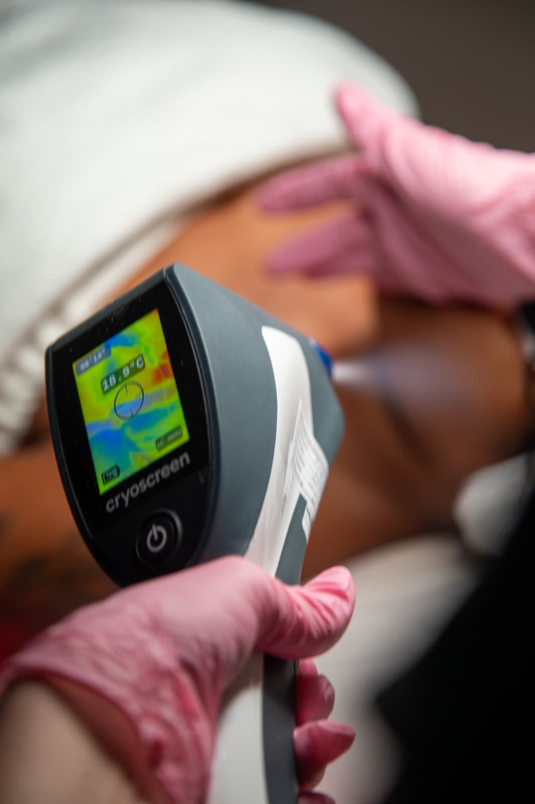 Medical Cryofacial